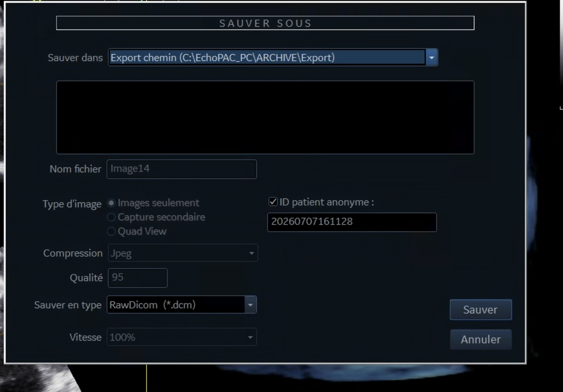 RawDicom and anonymization export settings